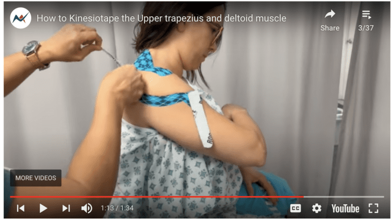 Hands on WEDNESDAY – Kinesiotaping the Upper Trapezius and Deltoid muscle